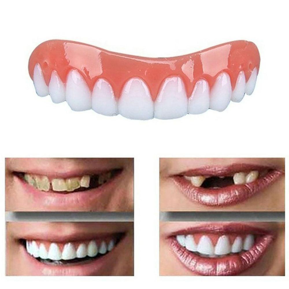 Dentadura Universal NewSmile Ajustável, Discreta e Confortável – Kit Prótese Dental Completa Compre 1 e Leve 2