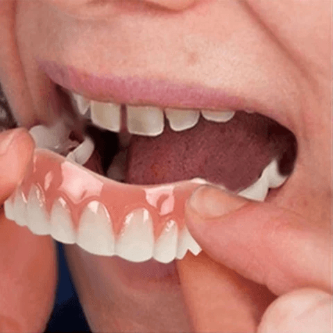 Dentadura Universal NewSmile Ajustável, Discreta e Confortável – Kit Prótese Dental Completa Compre 1 e Leve 2